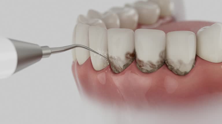 Reliable Dental Implants contractor in Dunnellon, FL by Smile Center Dentistry